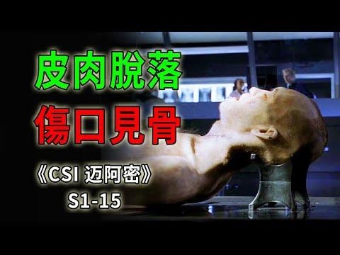 高濃度放射物殺人案，受害人皮肉脫落，傷口深可見骨《C.S.I-Miami》