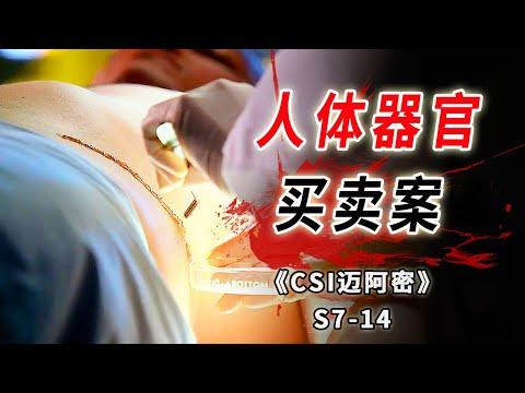 一顆腰子價值十萬美金 ，黑市醫生學藝不精割死病人《C.S.I-Miami》