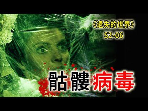 可怕的遠古骷髏病毒，感染者骨肉分離，化成一堆漿糊《遺失的世界》