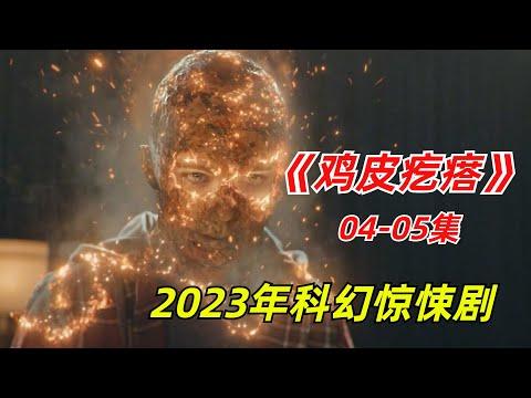 【阿奇】神奇蚯蚓侠降世，身体受伤后能够快速复原/2023年科幻惊悚剧《鸡皮疙瘩》04+05集